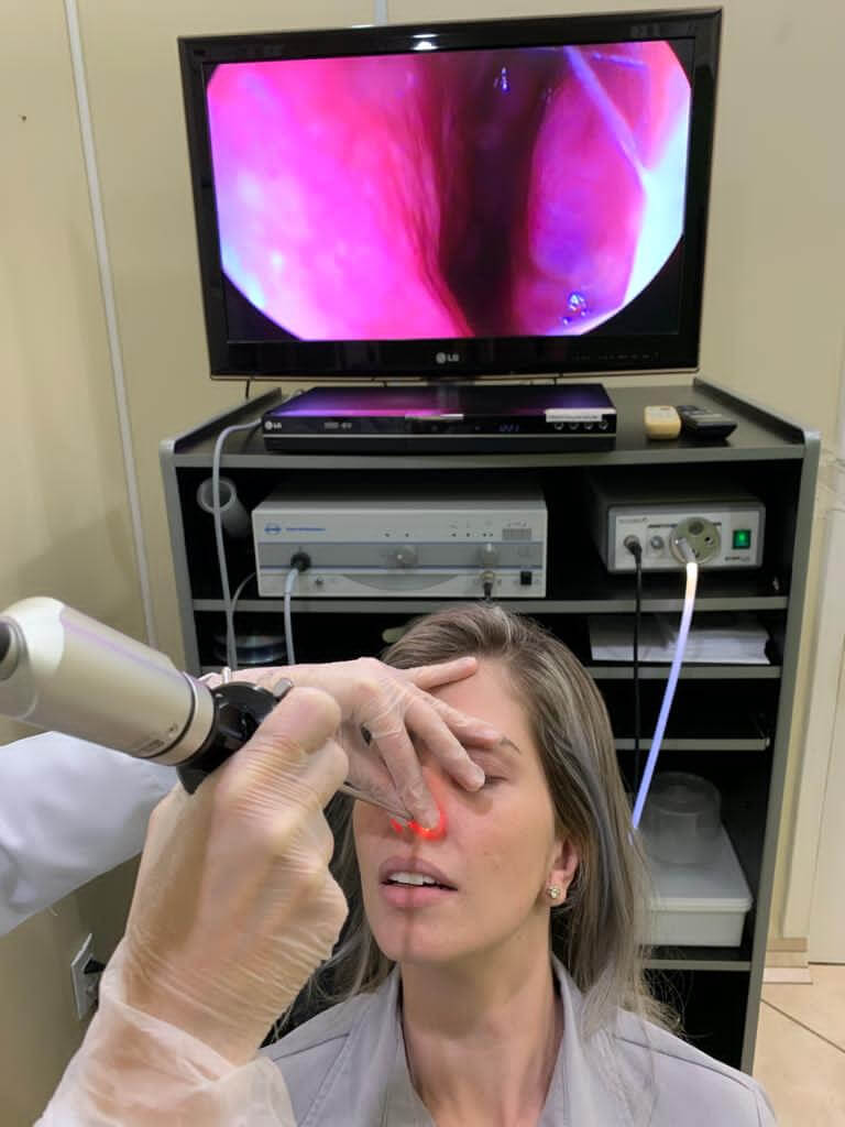 V deo Endoscopia Nasal ou Nasofibroscopia Ou V deo Endoscopia Naso V deo Endoscopia Nasal ou Nasofibroscopia Ou V deo Endoscopia Naso